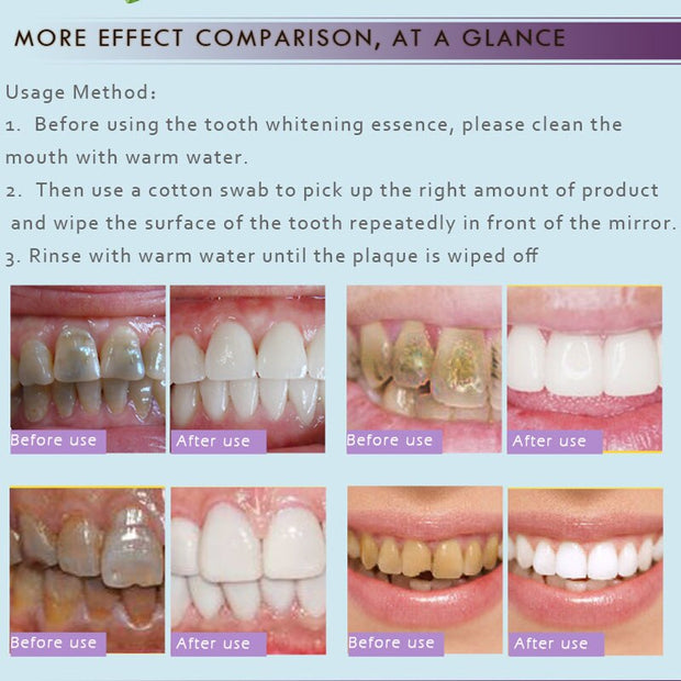 Esencia para blanquear los dientes