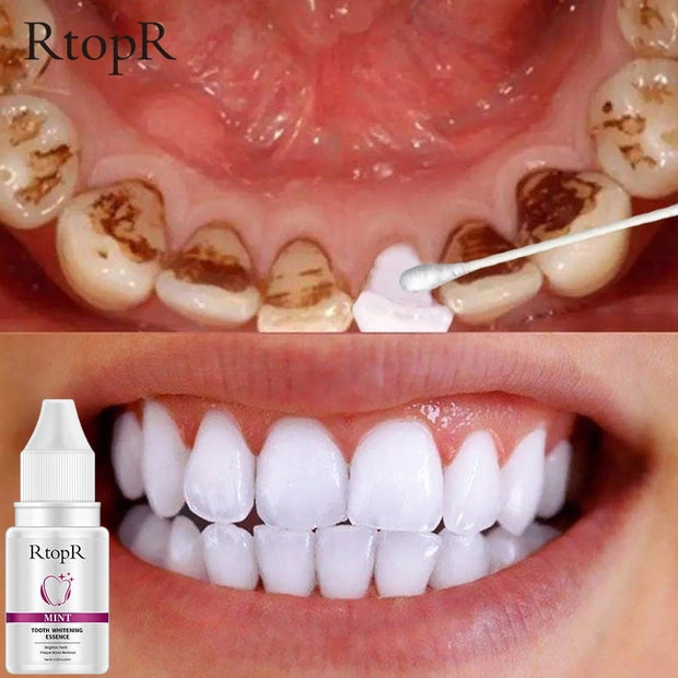 PureSmile Teeth Whitening Essence